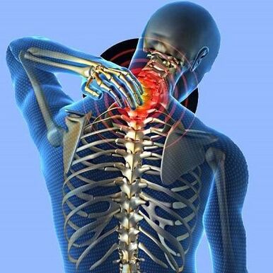 Dureri de gât cu osteochondroză cervicală